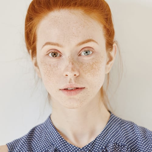 National Different Colored Eyes Day